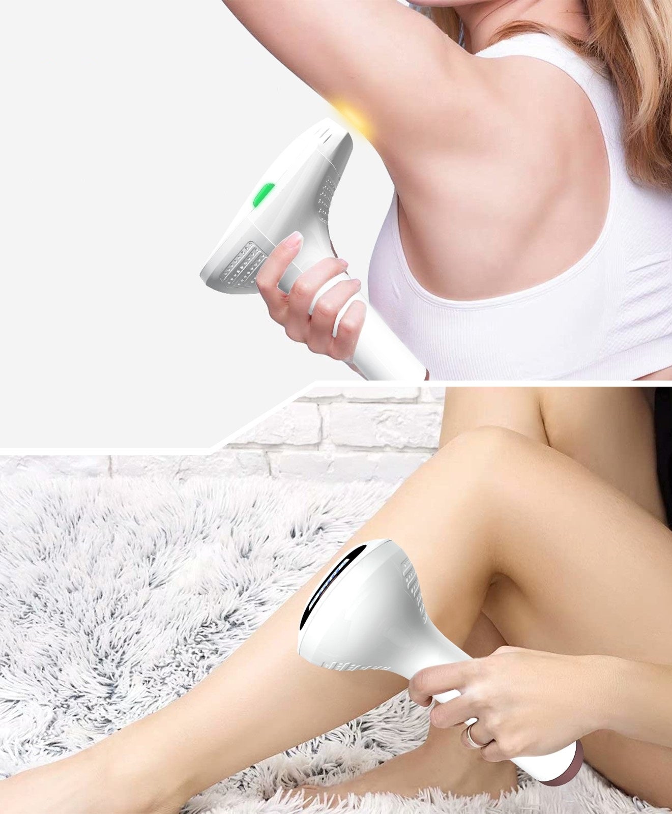 Laser hair removal