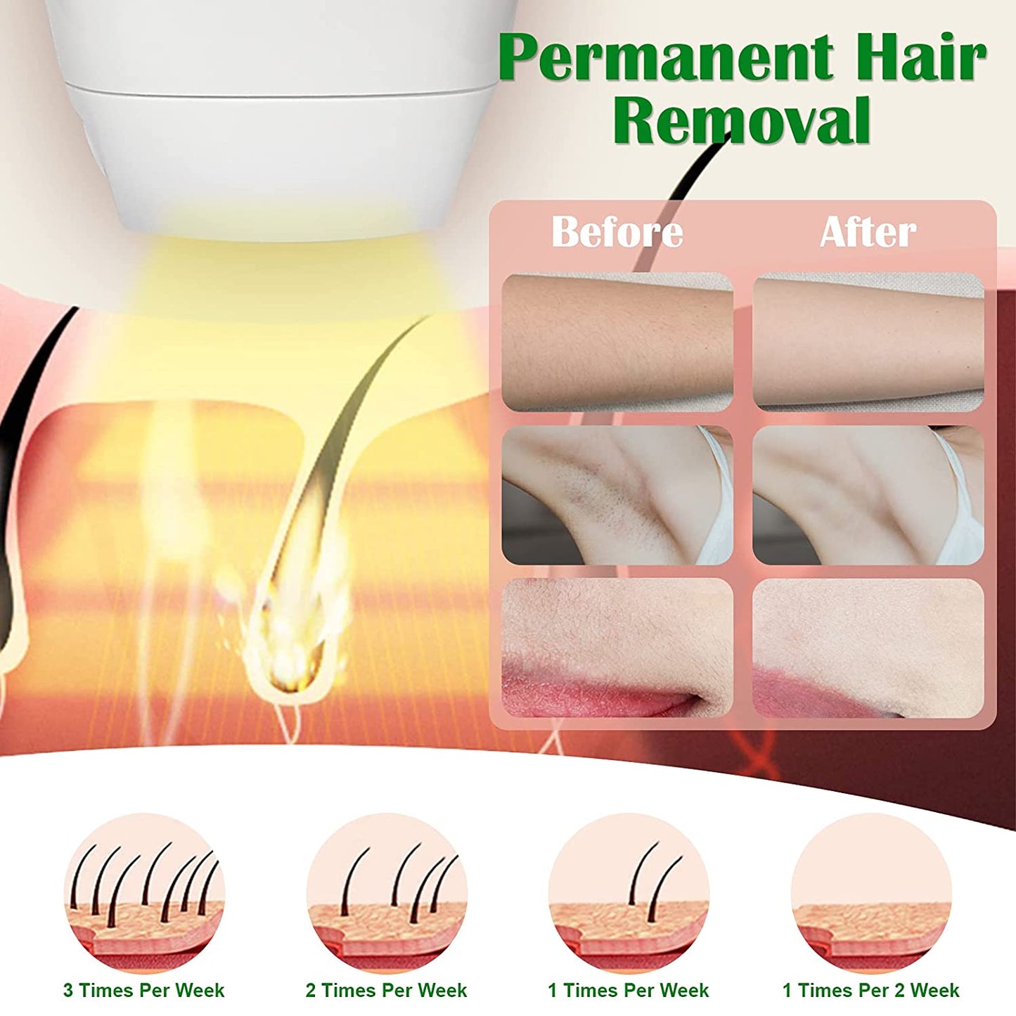 IPL Laser Hair Removal with FDA certified & 999,900 Flashes